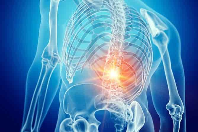 14درمان سریع کمردرد شدیدکمپرس سرد و گرم، کلسیم و فیزیوتراپی