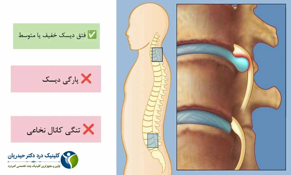 دیسکوژل
