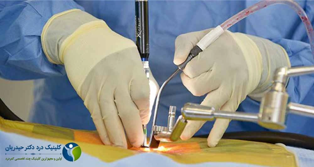 جراحیهای کمتر تهاجمی