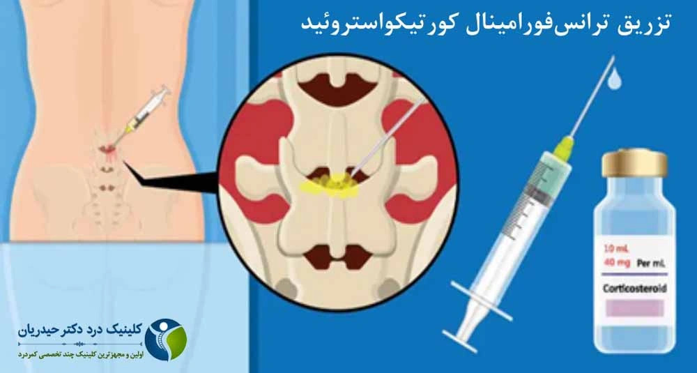 روشهای تزریقی درمانی