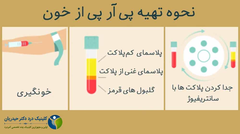 پی آر پی 
