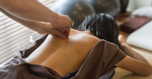 طب سوزنی برای درمان درد بین دو کتف