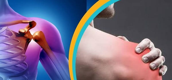 تزریق پی آر پی برای درمان بی ثباتی شانه