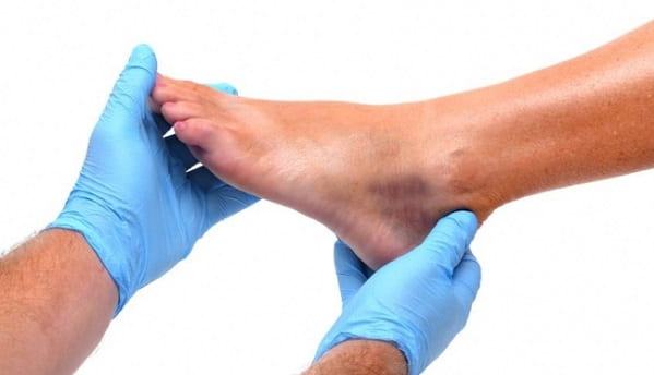 درد کف پا چگونه تشخیص داده می‌شود؟