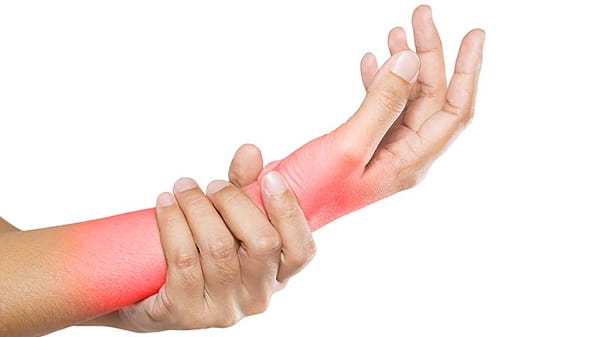 تزریق پی آر پی برای درمان سندرم تونل کارپال